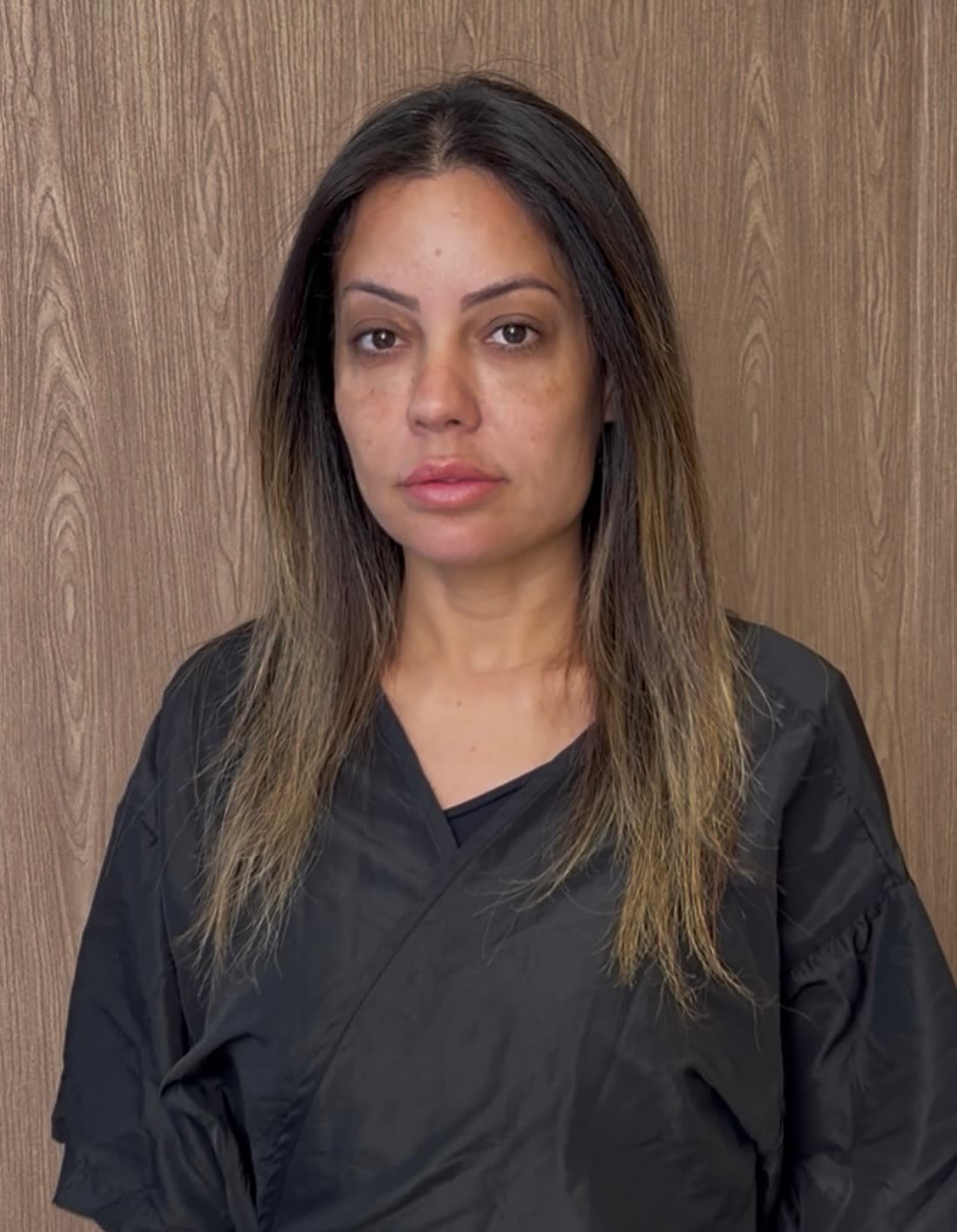 Antes — cabelo natural antes da transformação (Caso 03)